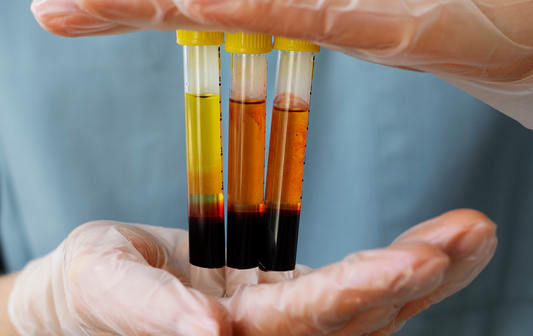 Exosome/PRP/Stem Cell